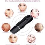 درما اف التراسونیک شاول اصلی | اتو پوست حرفهای کرهای برای لایهبرداری و جوانسازی پوست - Image 3