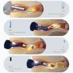 نحوه استفاده از گوش پاک‌کن هوشمند شیائومی